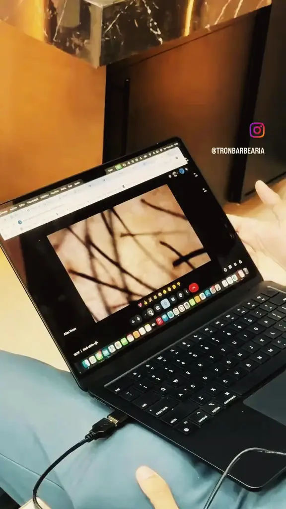 Análise capilar ampliada na tela de um notebook