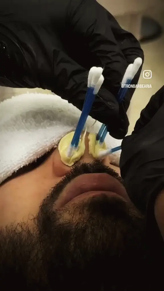 Aplicação de cera com toalha quente no rosto do cliente
